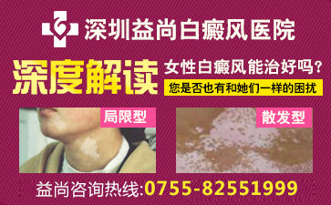 深圳白癜风医院最好的解读孕期白癜风病人该如何进行预防的措施